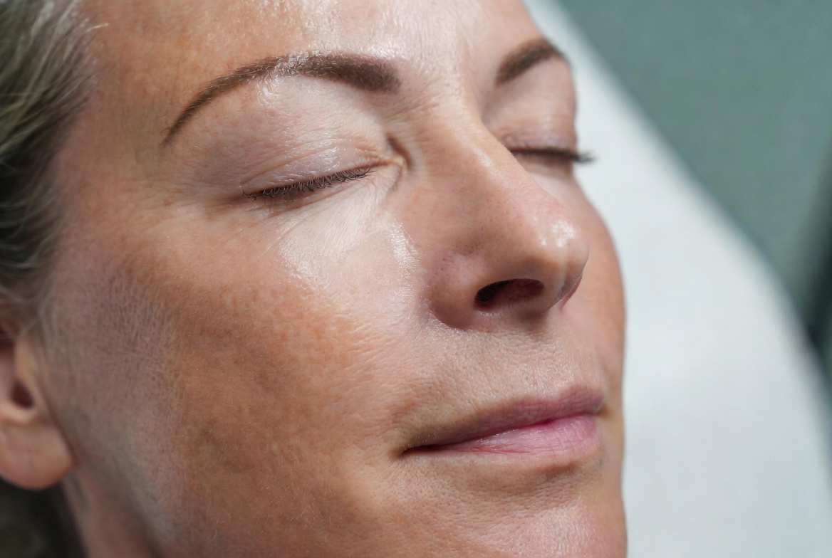 Neuromodulazione & Filler